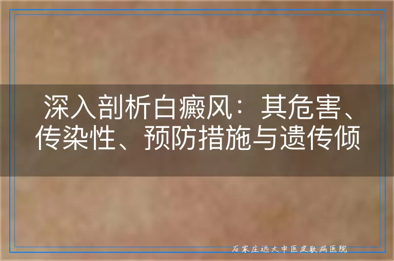 深入剖析白癜风：其危害、传染性、预防措施与遗传倾向-环球网健康频道特别报道
