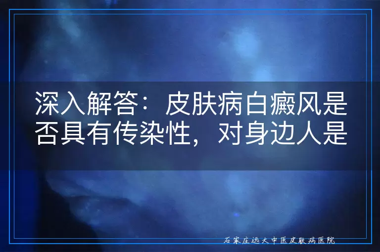 深入解答：皮肤病白癜风是否具有传染性，对身边人是否构成威胁？