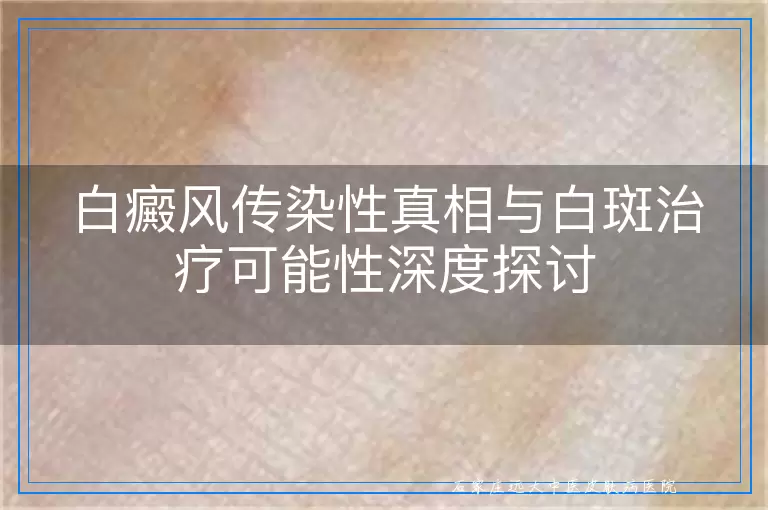 白癜风传染性真相与白斑治疗可能性深度探讨