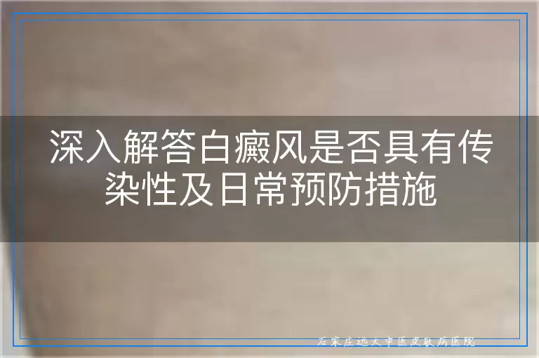 深入解答白癜风是否具有传染性及日常预防措施
