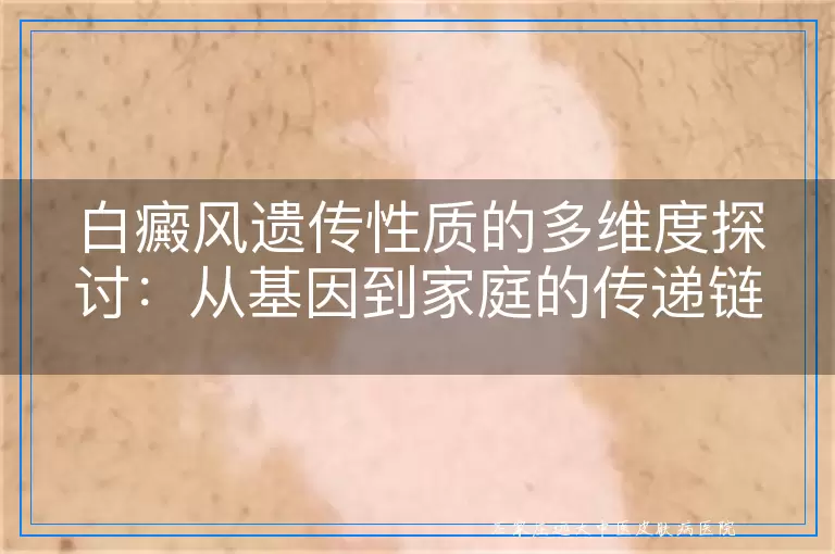 白癜风遗传性质的多维度探讨：从基因到家庭的传递链