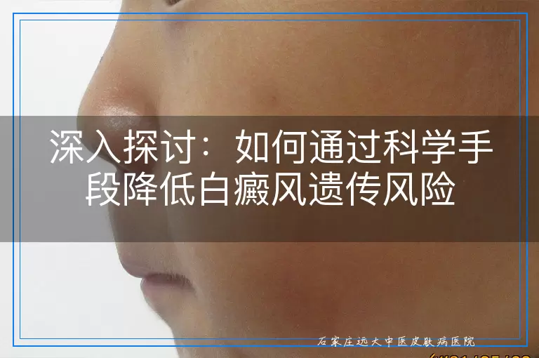 深入探讨：如何通过科学手段降低白癜风遗传风险