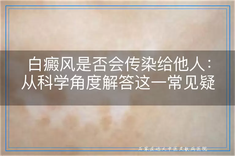 白癜风是否会传染给他人：从科学角度解答这一常见疑虑