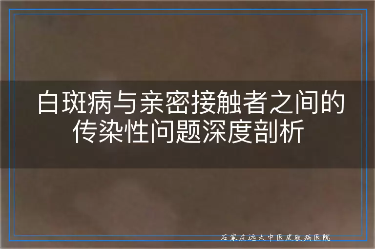 白斑病与亲密接触者之间的传染性问题深度剖析