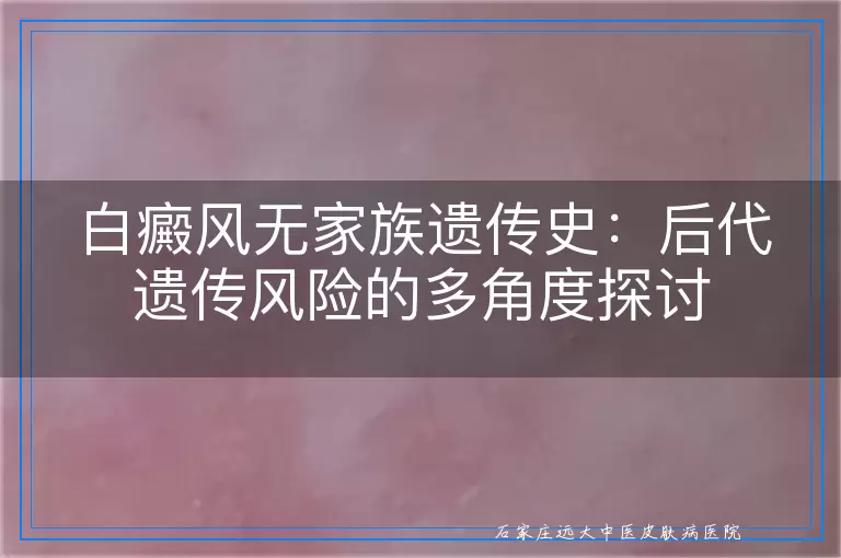 白癜风无家族遗传史：后代遗传风险的多角度探讨