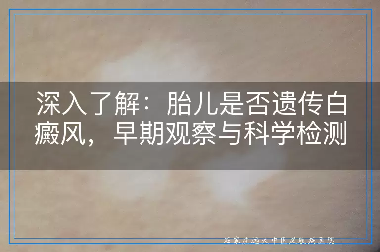 深入了解：胎儿是否遗传白癜风，早期观察与科学检测的可能性