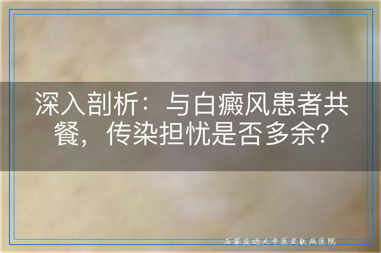 深入剖析：与白癜风患者共餐，传染担忧是否多余？