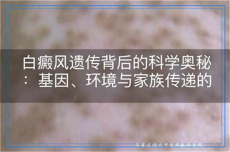 白癜风遗传背后的科学奥秘：基因、环境与家族传递的交织
