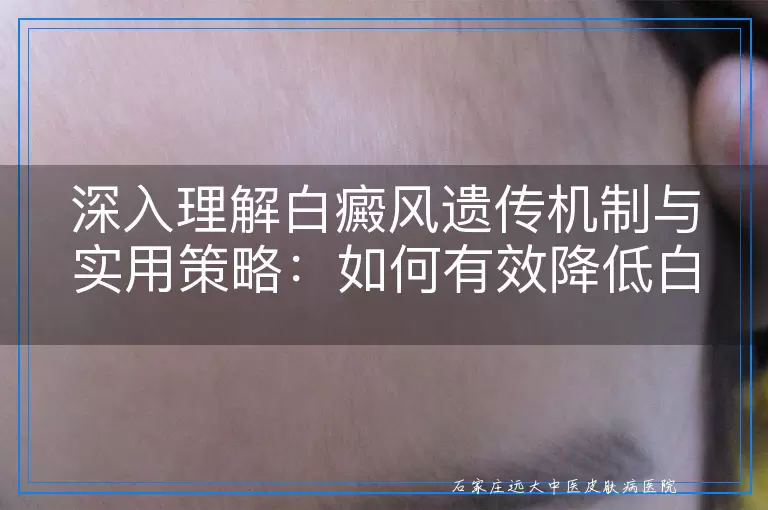 深入理解白癜风遗传机制与实用策略：如何有效降低白癜风遗传风险