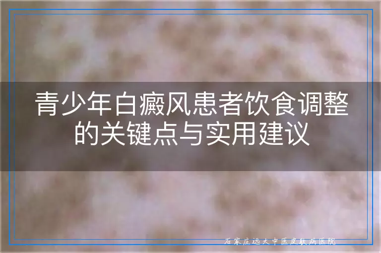 青少年白癜风患者饮食调整的关键点与实用建议