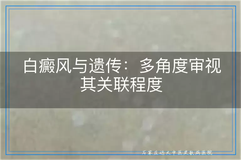 白癜风与遗传：多角度审视其关联程度