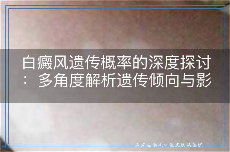 白癜风遗传概率的深度探讨：多角度解析遗传倾向与影响因素