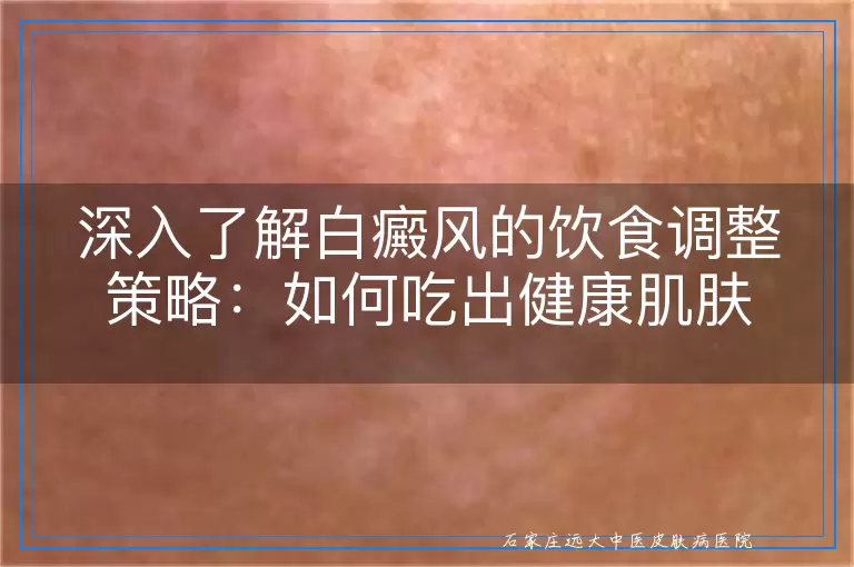 深入了解白癜风的饮食调整策略：如何吃出健康肌肤