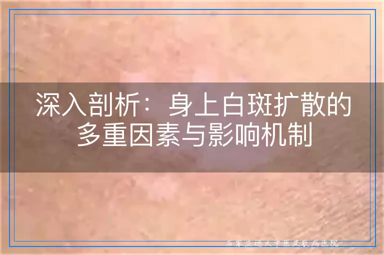 深入剖析：身上白斑扩散的多重因素与影响机制