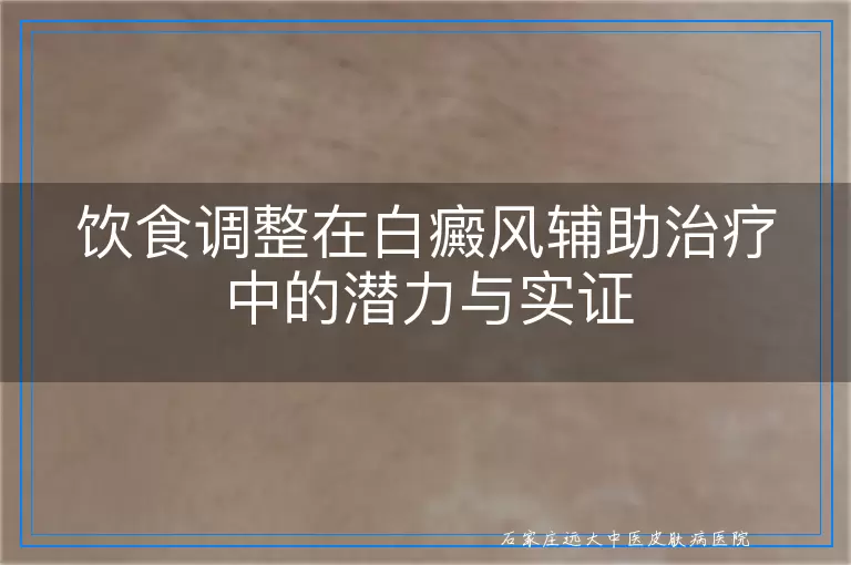 饮食调整在白癜风辅助治疗中的潜力与实证