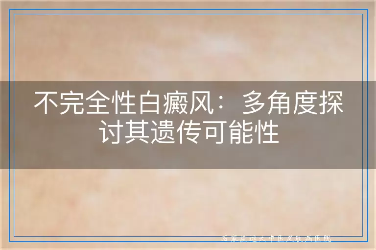 不完全性白癜风：多角度探讨其遗传可能性