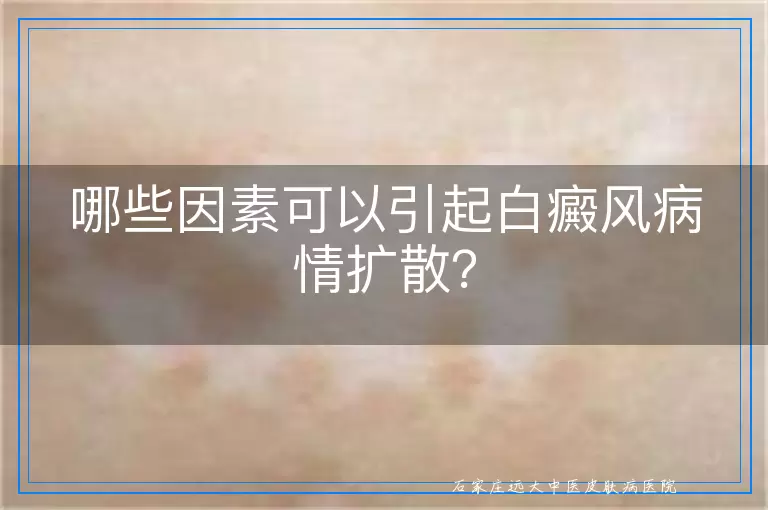 哪些因素可以引起白癜风病情扩散？