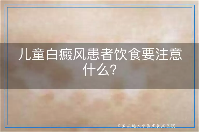 儿童白癜风患者饮食要注意什么？