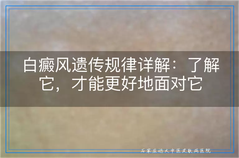 白癜风遗传规律详解：了解它，才能更好地面对它