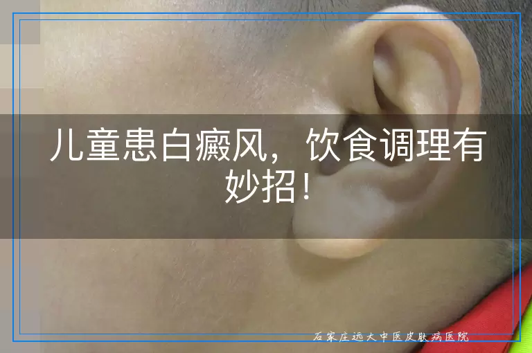 儿童患白癜风，饮食调理有妙招！