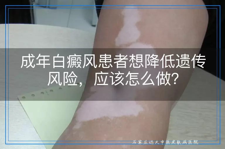 成年白癜风患者想降低遗传风险，应该怎么做？