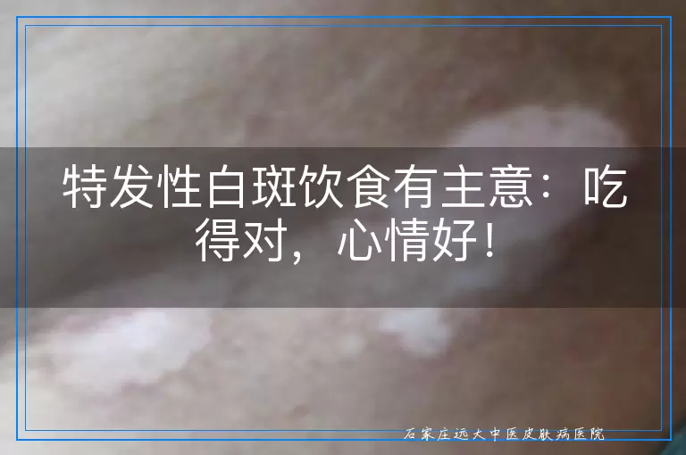 特发性白斑饮食有主意：吃得对，心情好！