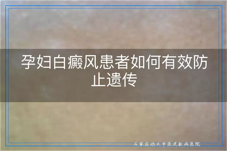孕妇白癜风患者如何有效防止遗传