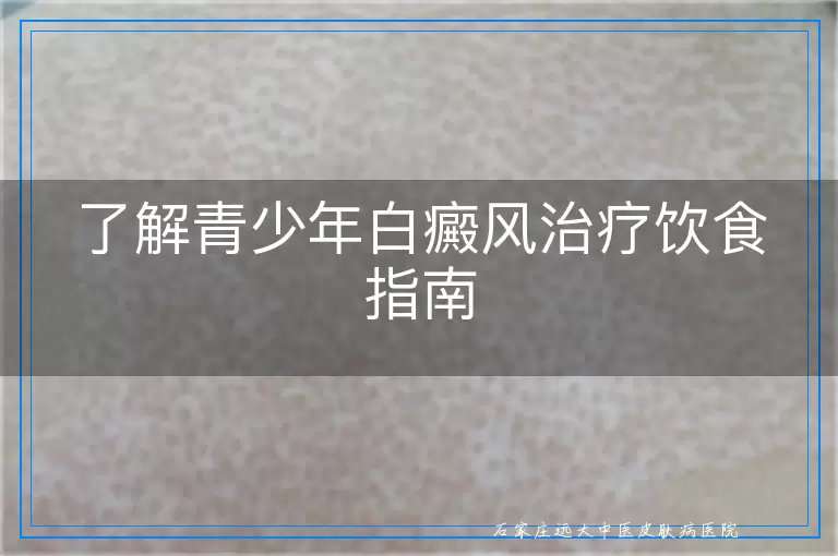 了解青少年白癜风治疗饮食指南