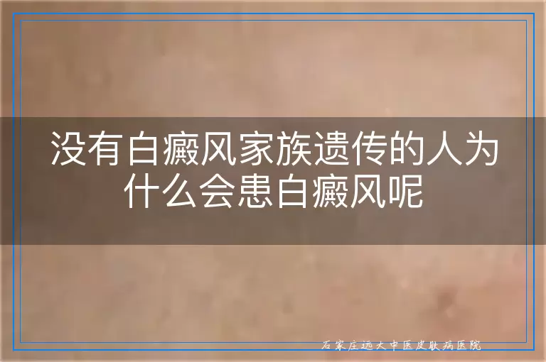 没有白癜风家族遗传的人为什么会患白癜风呢