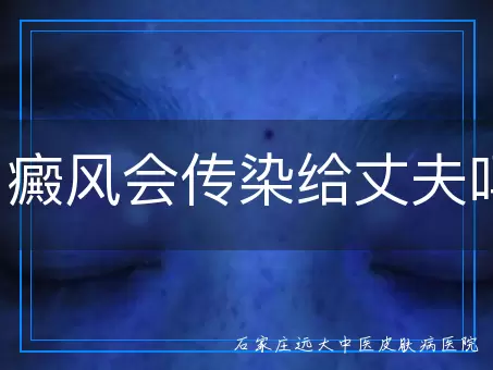 白癜风会传染给丈夫吗？