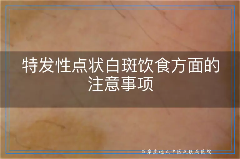 特发性点状白斑饮食方面的注意事项