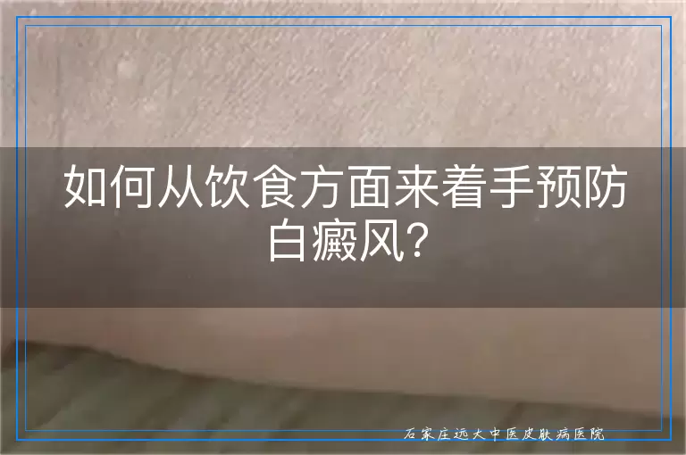 如何从饮食方面来着手预防白癜风？