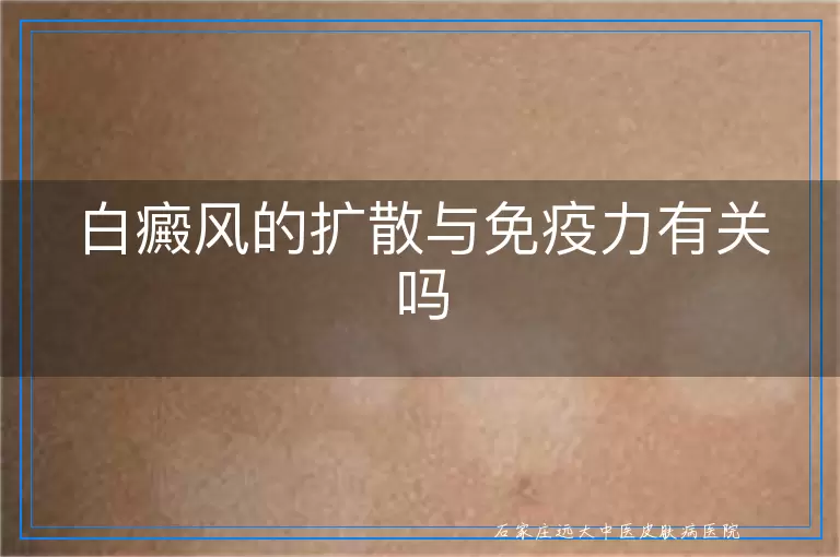 白癜风的扩散与免疫力有关吗