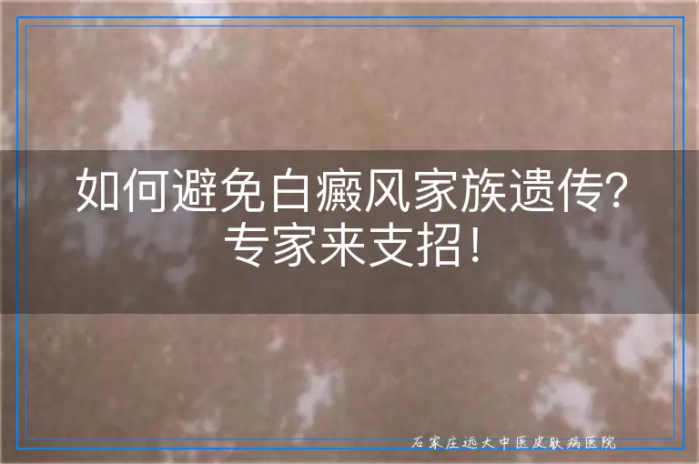 如何避免白癜风家族遗传？专家来支招！
