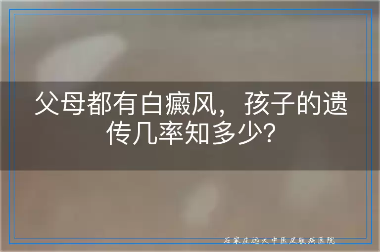 父母都有白癜风，孩子的遗传几率知多少？