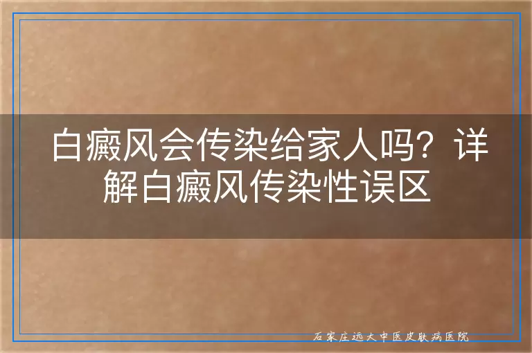 白癜风会传染给家人吗？详解白癜风传染性误区