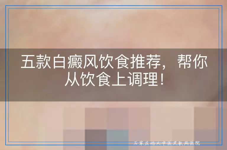 五款白癜风饮食推荐，帮你从饮食上调理！