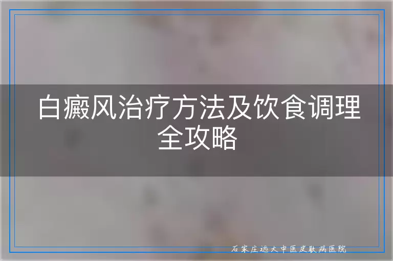 白癜风治疗方法及饮食调理全攻略