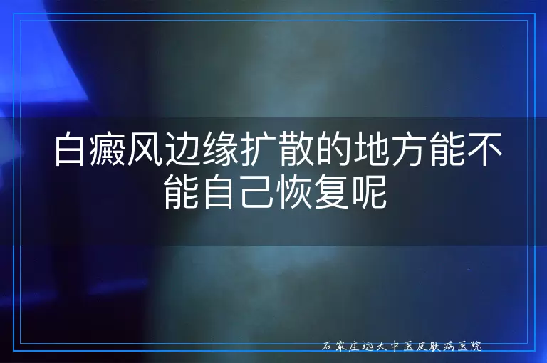 白癜风边缘扩散的地方能不能自己恢复呢