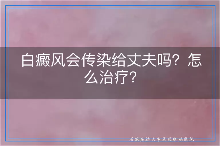 白癜风会传染给丈夫吗？怎么治疗？