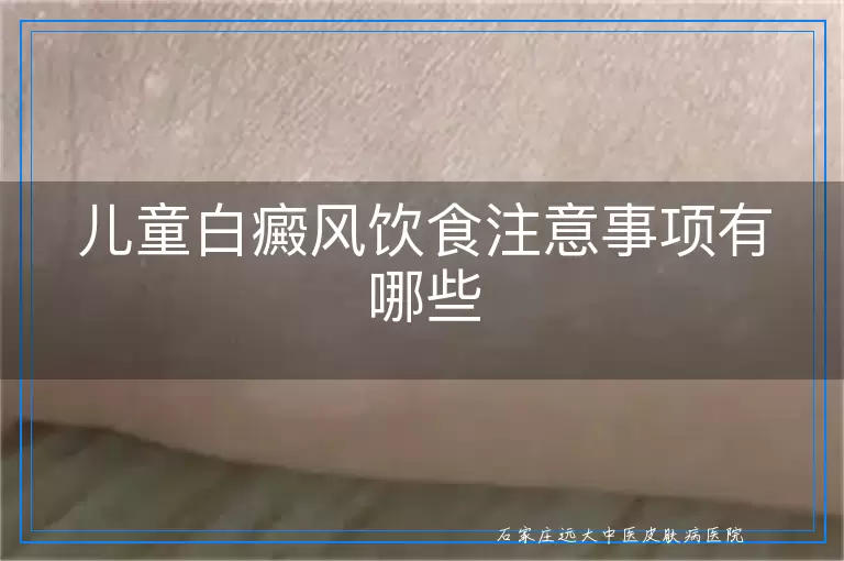 儿童白癜风饮食注意事项有哪些