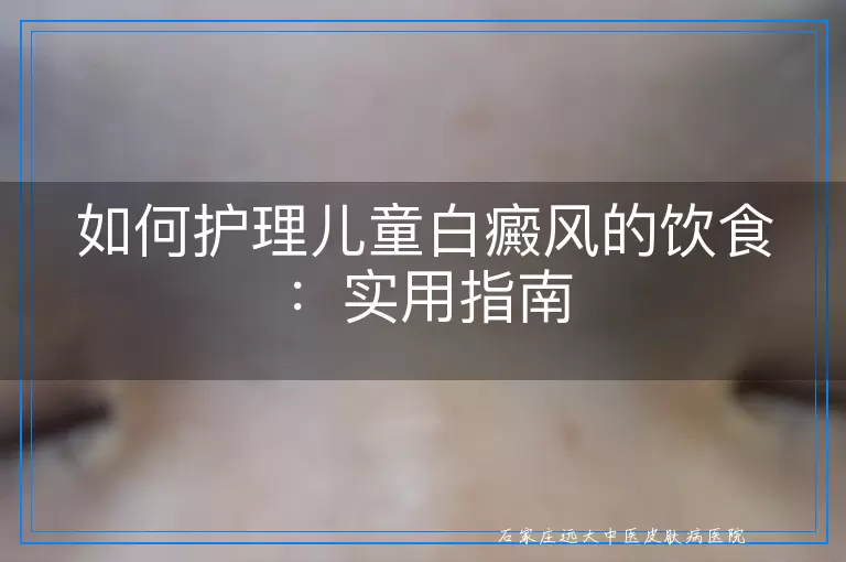 如何护理儿童白癜风的饮食：实用指南