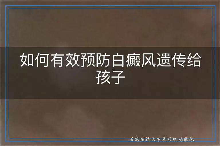 如何有效预防白癜风遗传给孩子