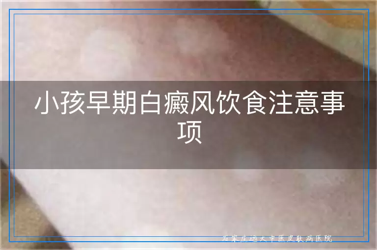 小孩早期白癜风饮食注意事项