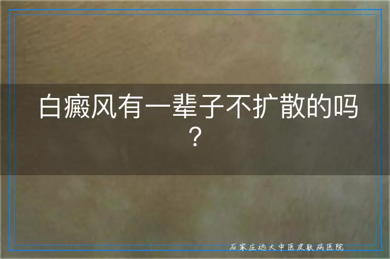 白癜风有一辈子不扩散的吗？