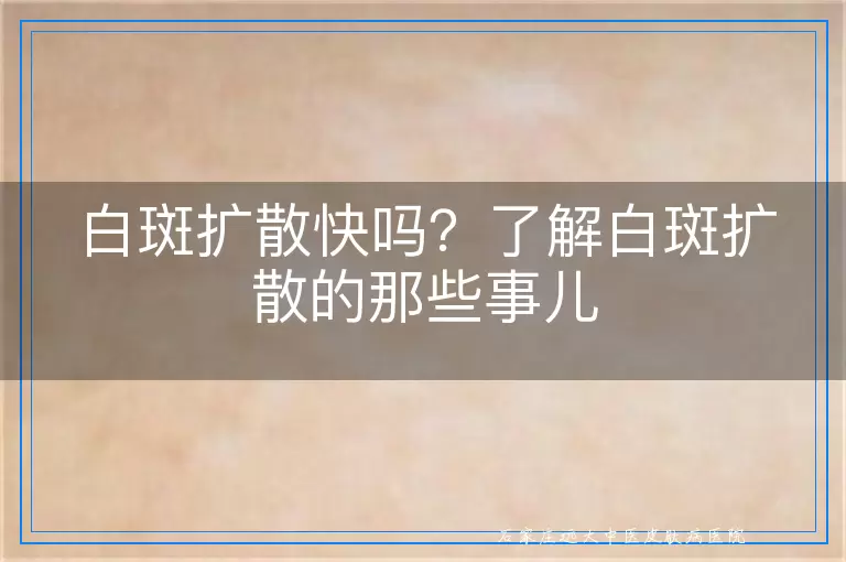 白斑扩散快吗？了解白斑扩散的那些事儿