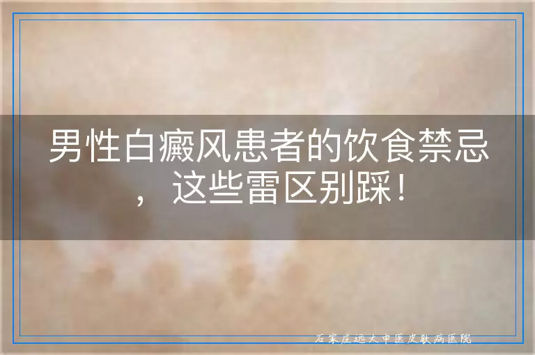 男性白癜风患者的饮食禁忌，这些雷区别踩！