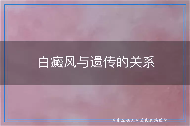 白癜风与遗传的关系