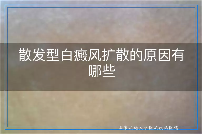 散发型白癜风扩散的原因有哪些