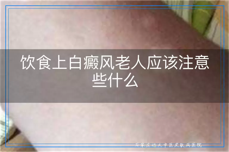 饮食上白癜风老人应该注意些什么